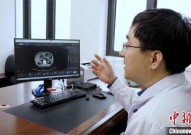 老人头晕3天查CT无异常AI主动报警查出癌症头晕了几天都不见好转是怎么了